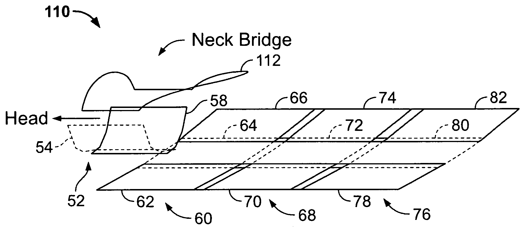 Cervical-thoracic-lumbar spine phased array coil for Magnetic Resonance Imaging