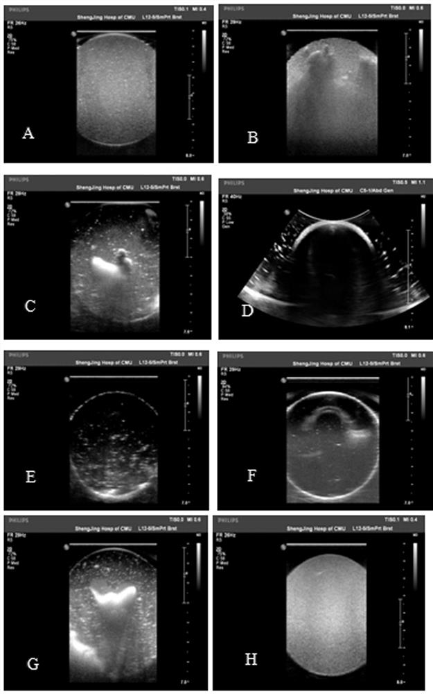 A ready-to-use liquid oral gastric ultrasound contrast agent formula and preparation method