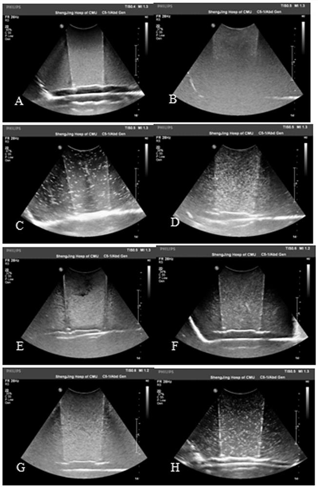 A ready-to-use liquid oral gastric ultrasound contrast agent formula and preparation method