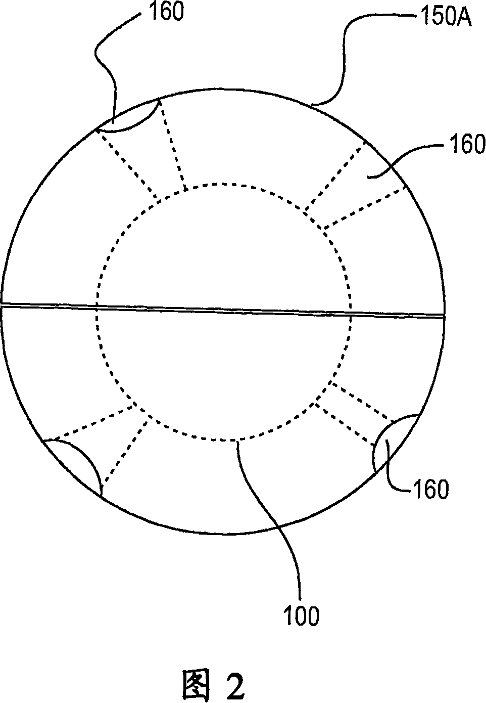 Anomaly detector for pipelines