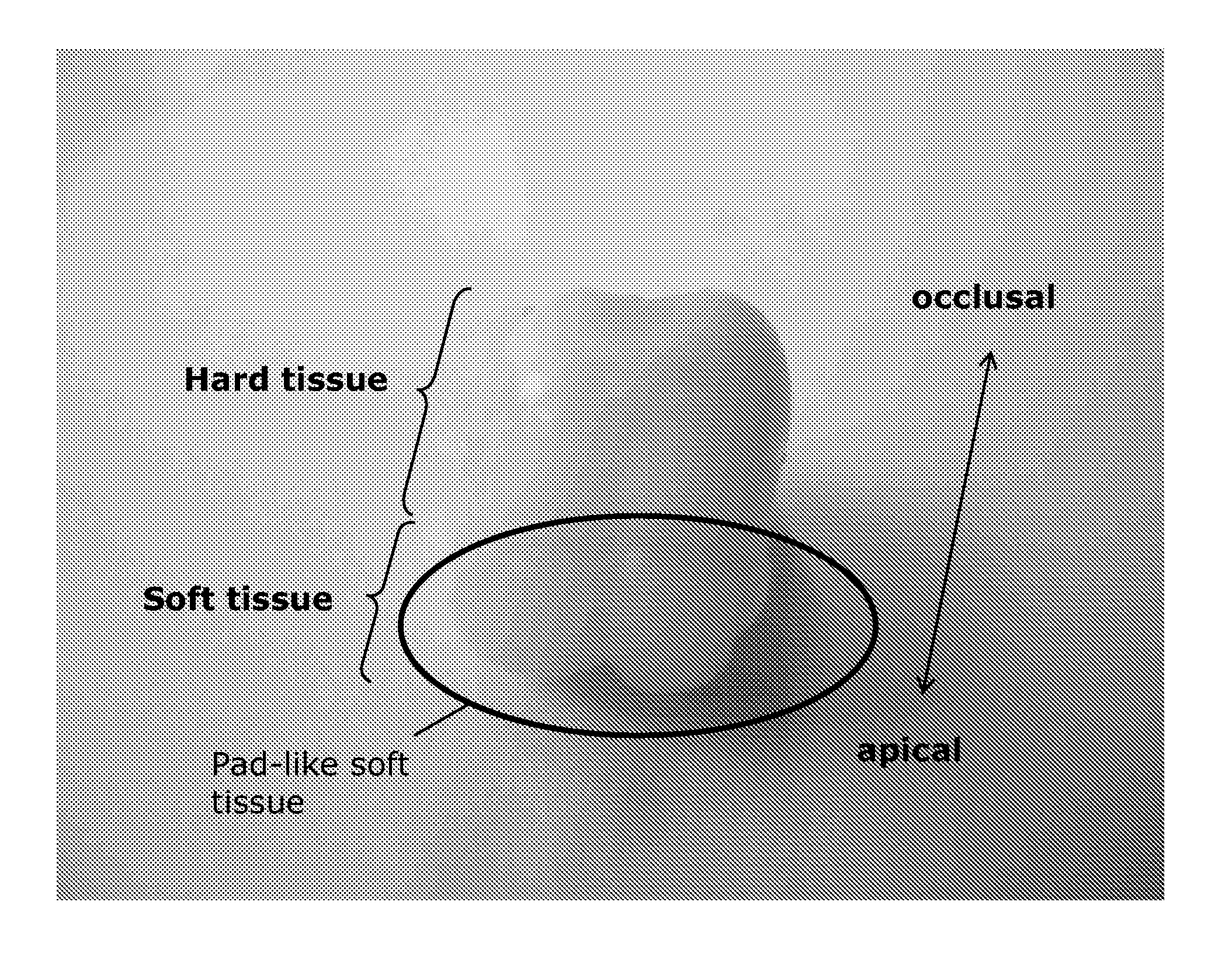 Method forisolating stem cells from cryopreserved dental tissue