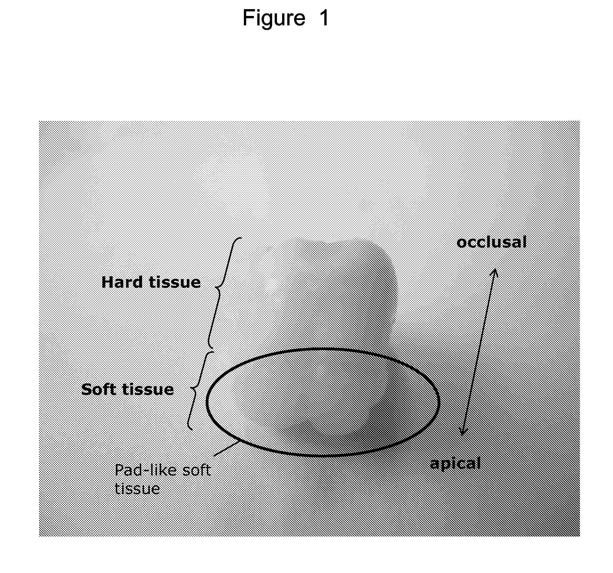 Method forisolating stem cells from cryopreserved dental tissue