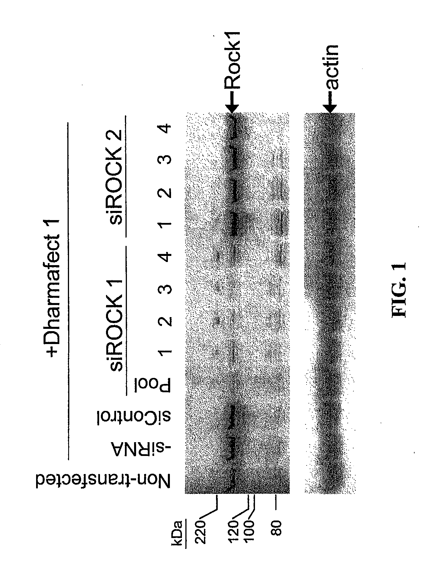 RNAi-Mediated Inhibition of RHO Kinase for Treatment of Ocular Disorders