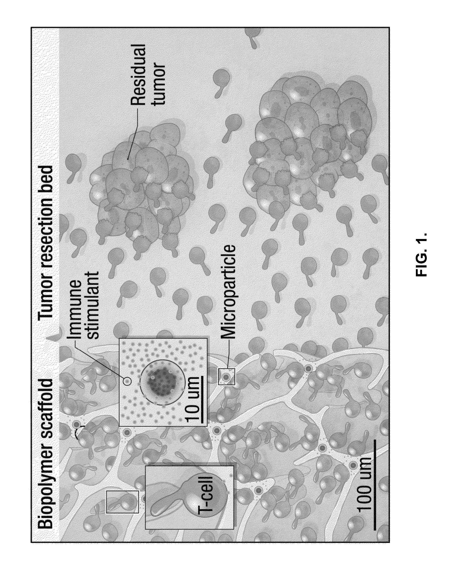 Compositions and methods for delivery of immune cells to treat un-resectable or non-resected tumor cells and tumor relapse