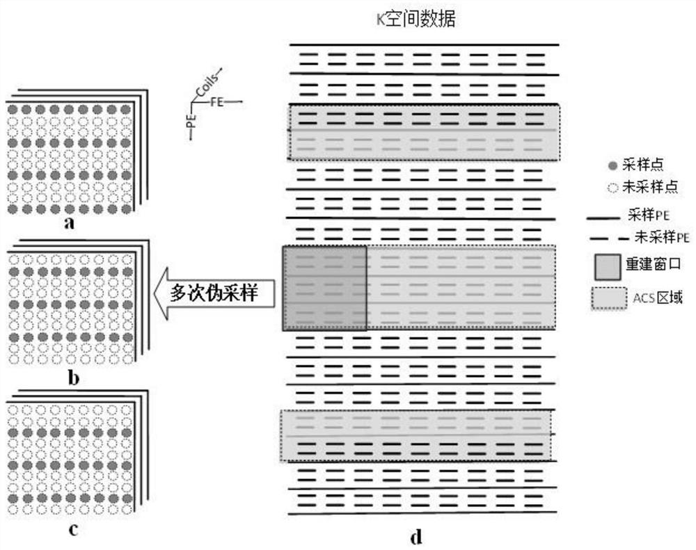 A Parallel Magnetic Resonance Imaging Method Based on Generative Adversarial Networks