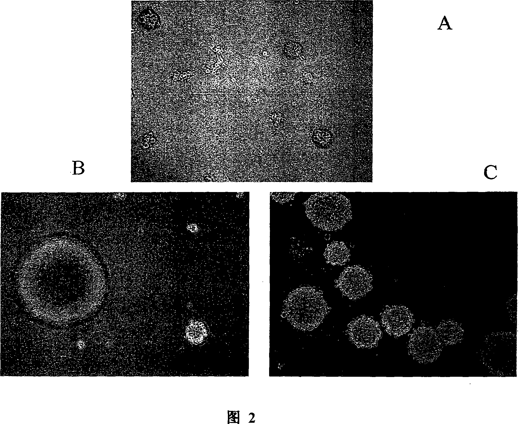 Compositions and methods to culturing neural stem cells with bone marrow stromal cells