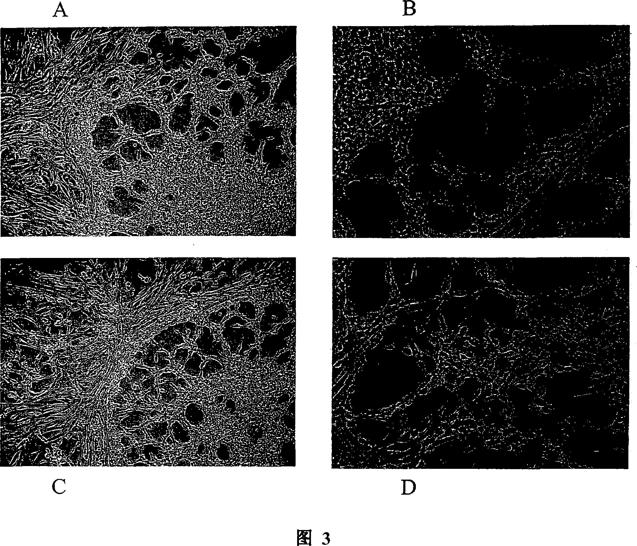 Compositions and methods to culturing neural stem cells with bone marrow stromal cells