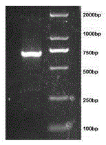 Construction and Application of Recombinant Adenoviral Vector of Survivin Promoter Regulating cd Gene