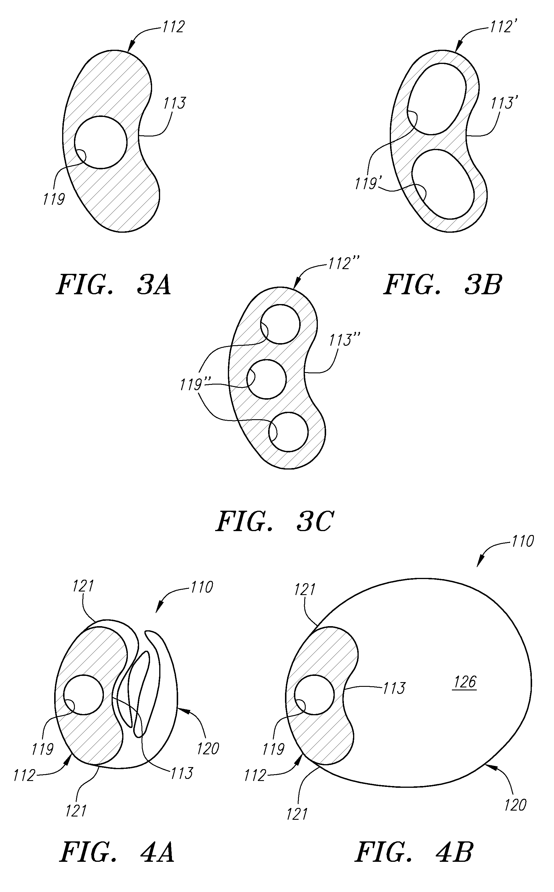 Expandable guide sheath and apparatus and methods for using such sheaths