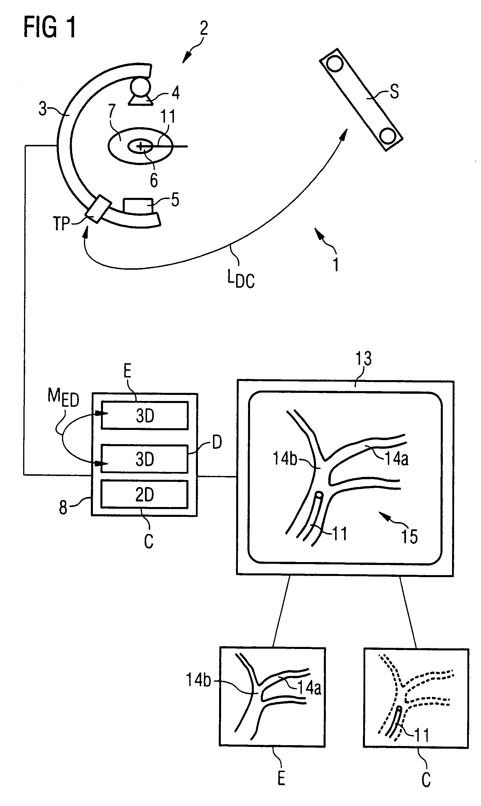 Method for marker-free automatic fusion of 2-D fluoroscopic C-arm images with preoperative 3D images using an intraoperatively obtained 3D data record
