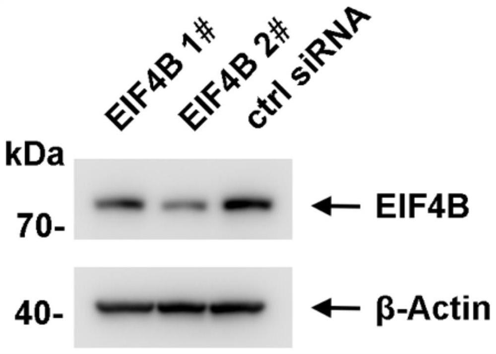 Application of eukaryotic translation initiation factor EIF4B as Ebola virus disease treatment target