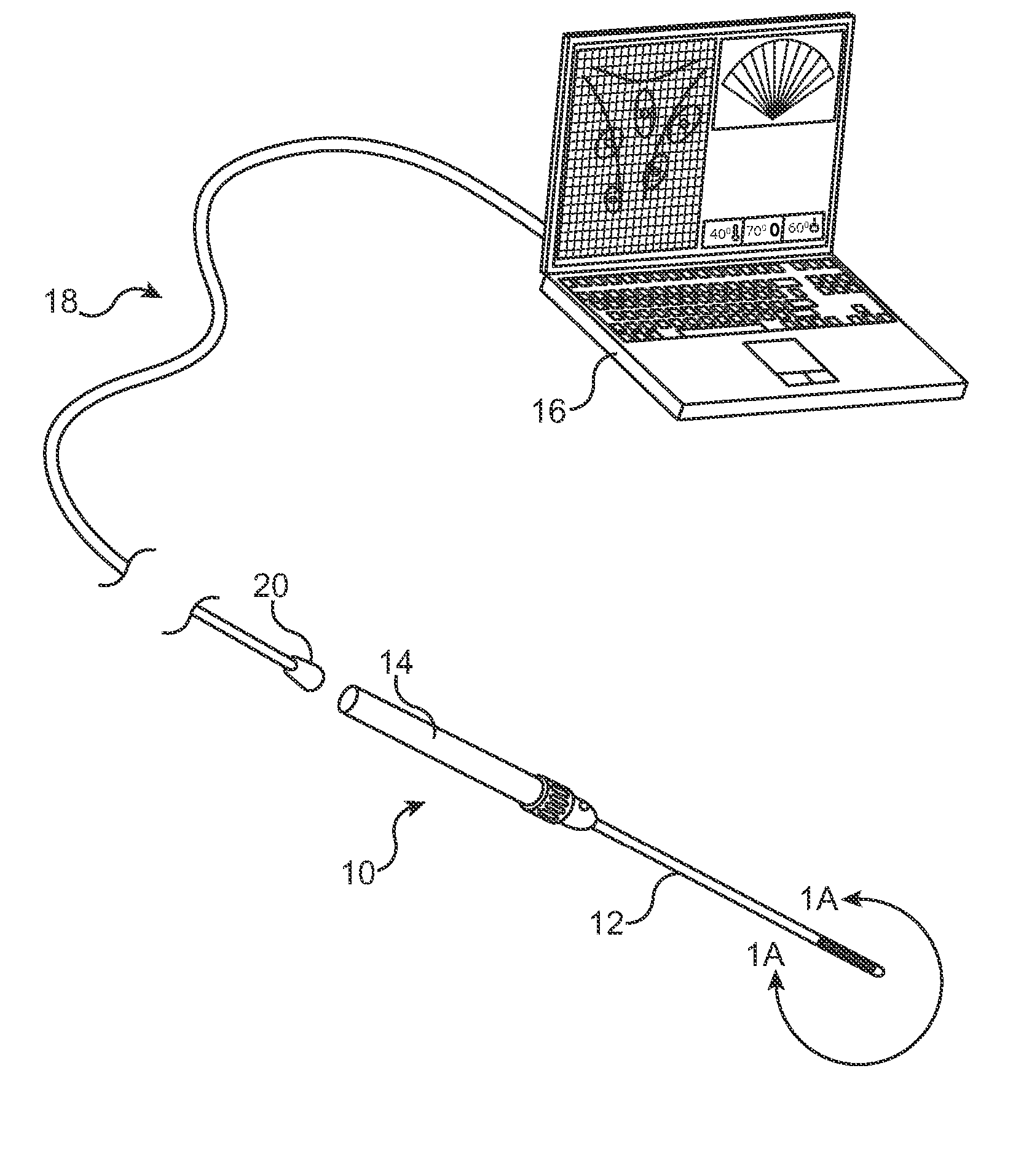 Intrauterine ultrasound and method for use