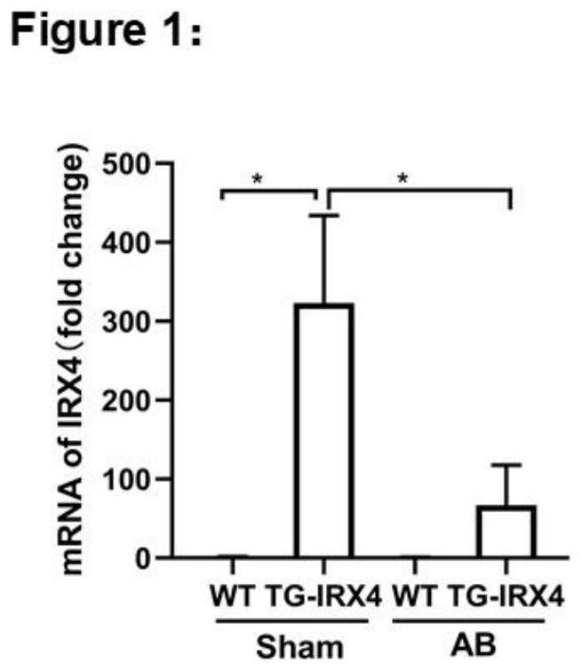 Application of IRX4 and inducer thereof in screening/preparing medicine for protecting heart