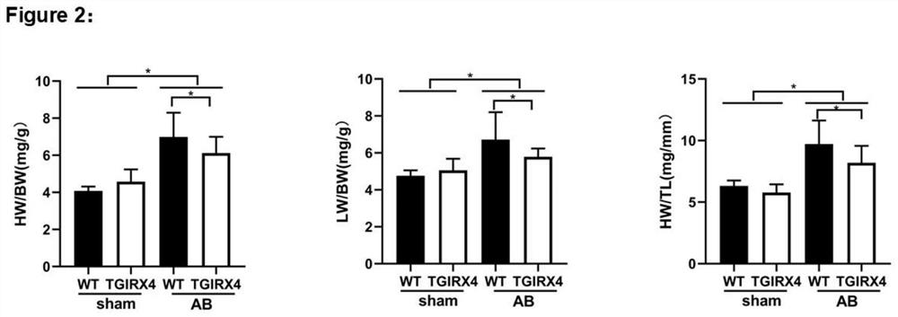 Application of IRX4 and inducer thereof in screening/preparing medicine for protecting heart