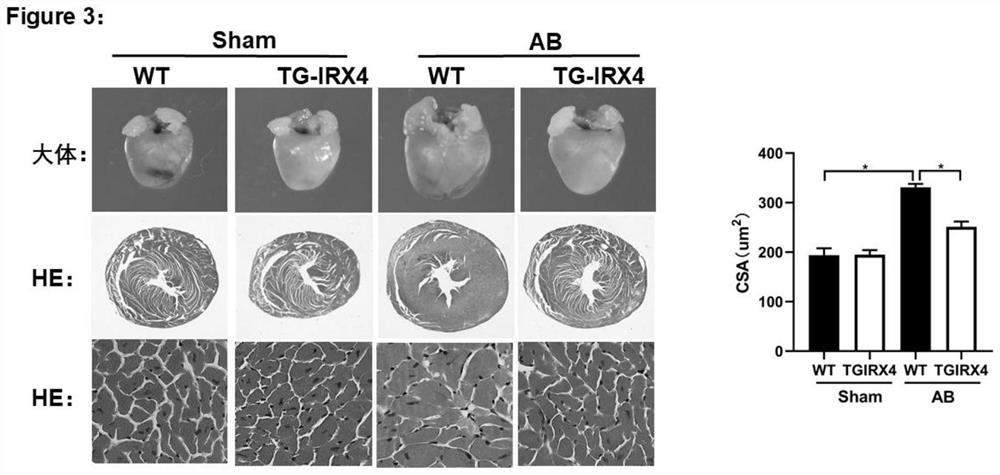 Application of IRX4 and inducer thereof in screening/preparing medicine for protecting heart