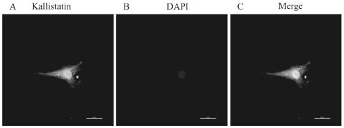 Ovarian hyperstimulation syndrome (OHSS) diagnostic marker Kallistatin and application thereof