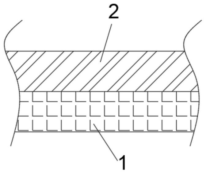 Penis albuginea repairing patch with double-layer structure and preparation method thereof
