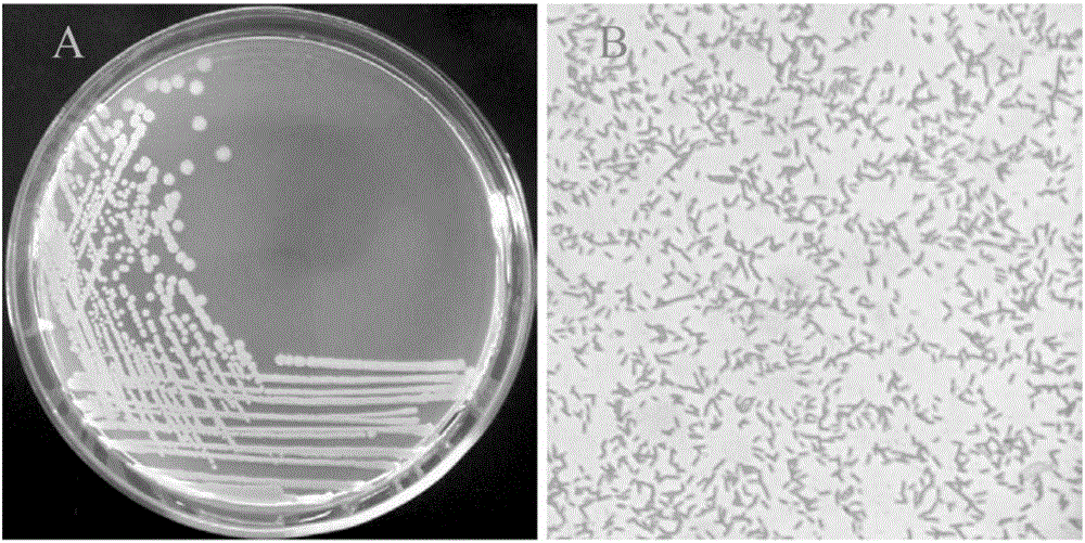 Lysinibacillus macroides capable of enriching phosphorus and degrading organophosphorus pesticides and application of lysinibacillus macroides