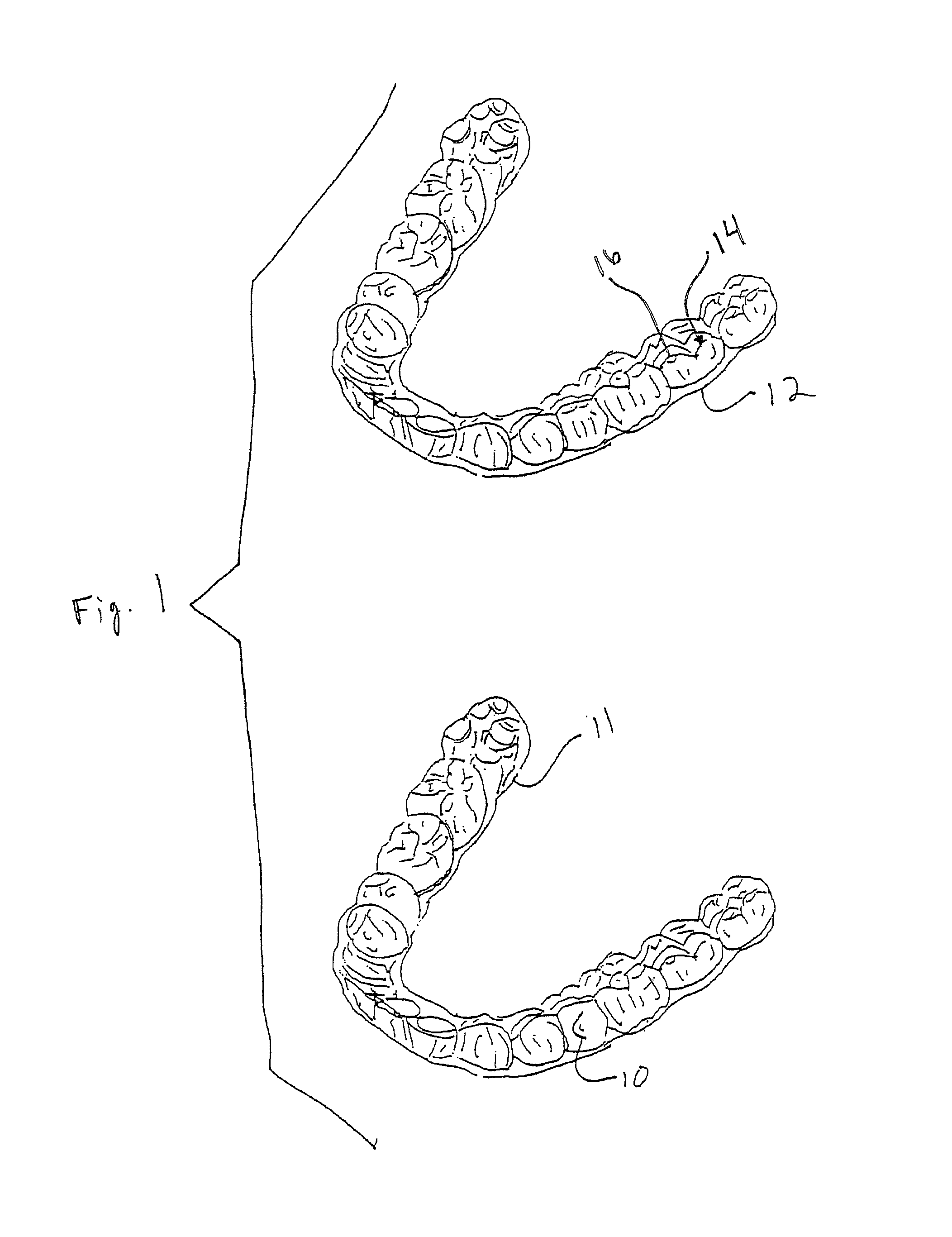 Method and system for personalized orthodontic treatment