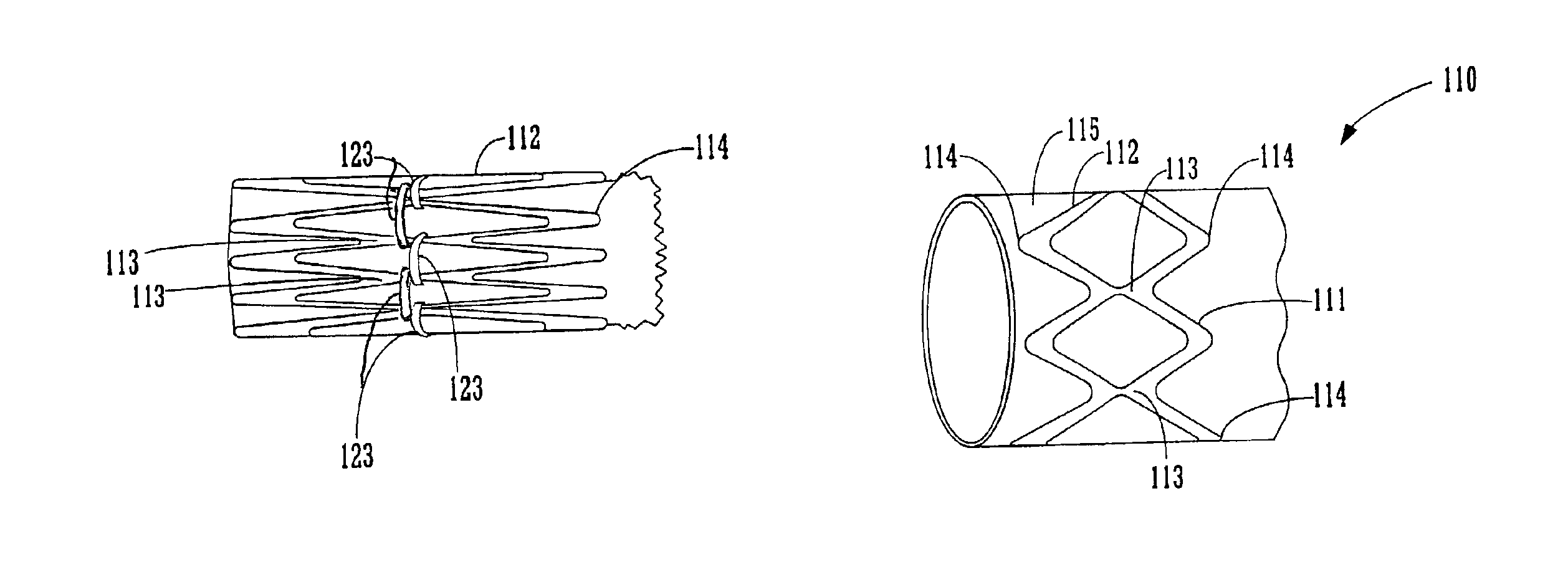 Stent graft loading and deployment device and method