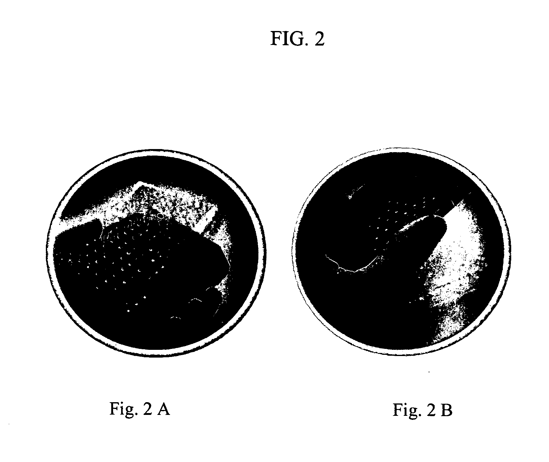 Methods and compositions for diagnosing lung cancer with specific DNA methylation patterns