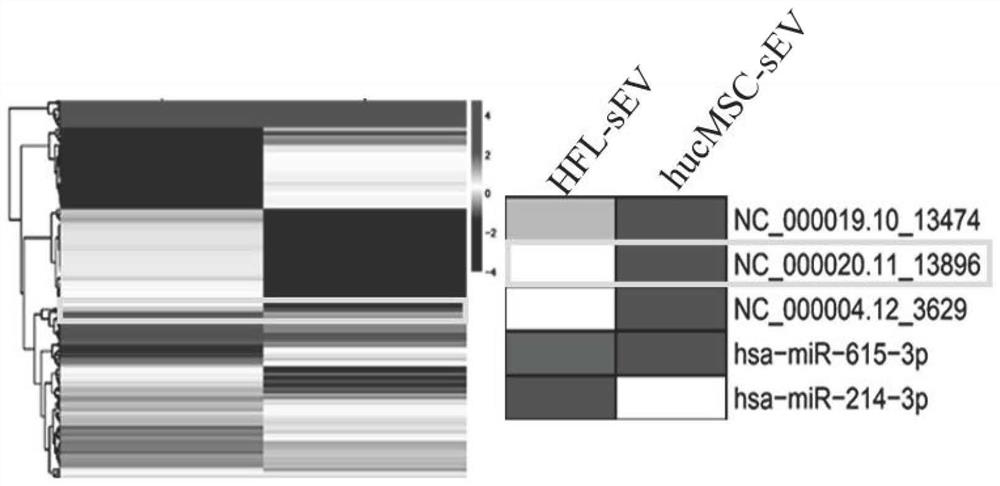 Application of HucMSC-sEV loaded with miR13896 to acute liver injury caused by sepsis