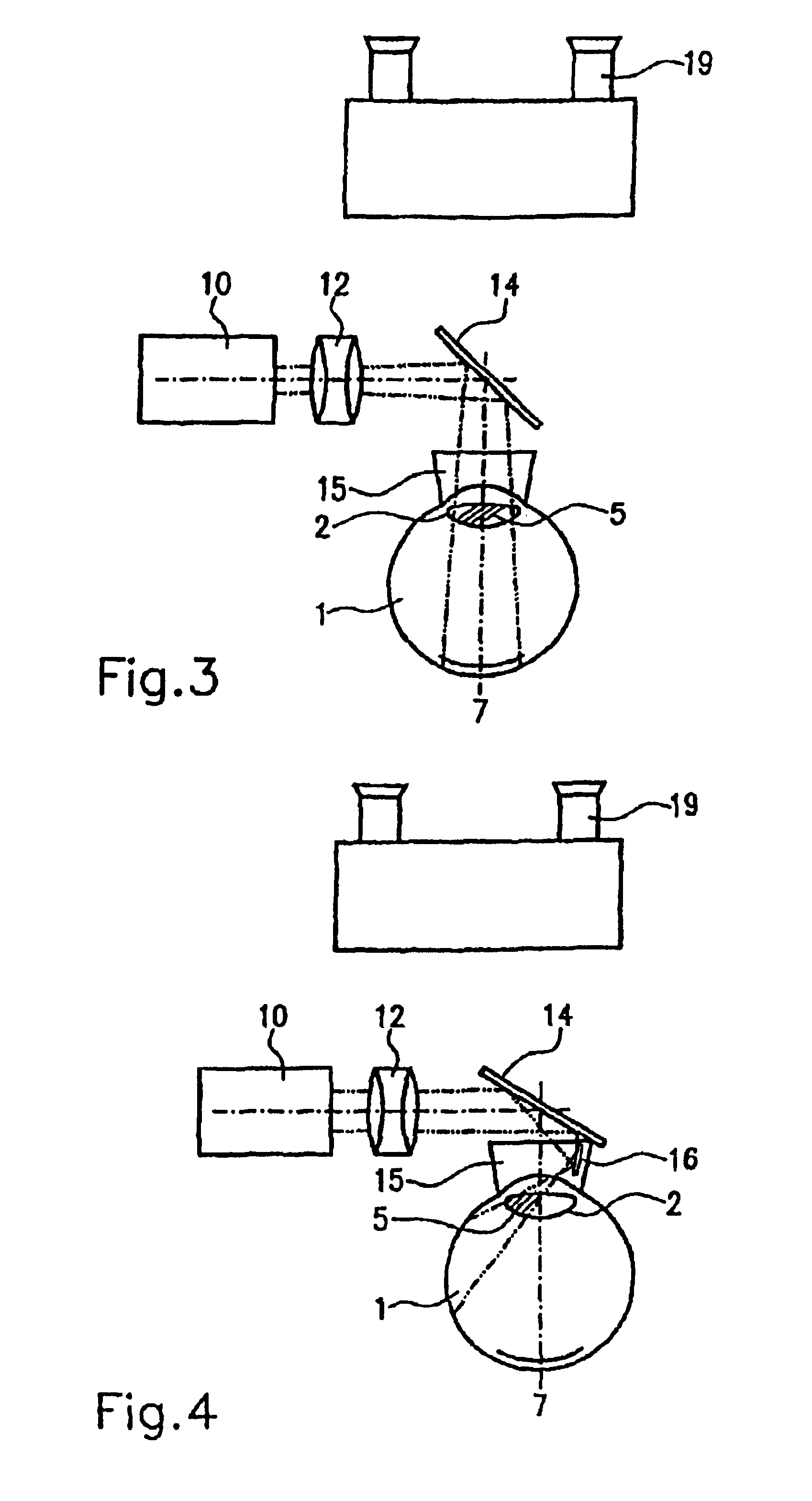 Method and device for treating opaqueness and/or hardening of a closed eye