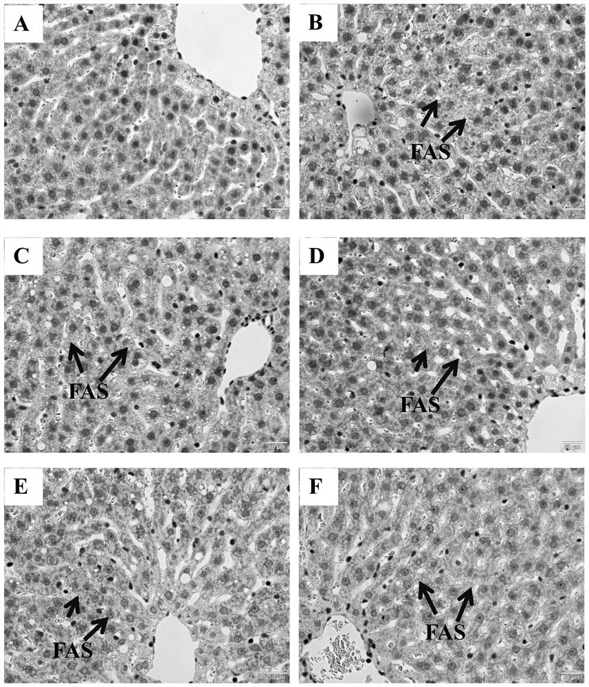 Application of Rhus chinensis Mill. fruit in preparation of medicine for treating or preventing non-alcoholic fatty liver disease