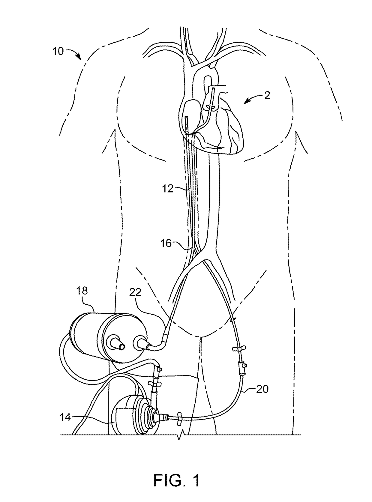 Cannula System with Sterile Connector, Blood Pump, and Patient Harness
