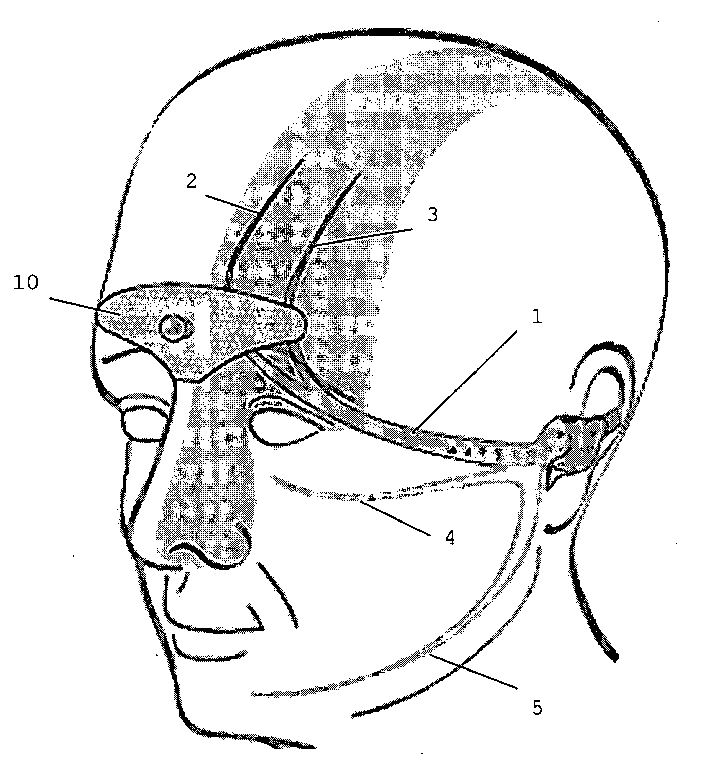 Device for the electrotherapeutic treatment of tension headaches