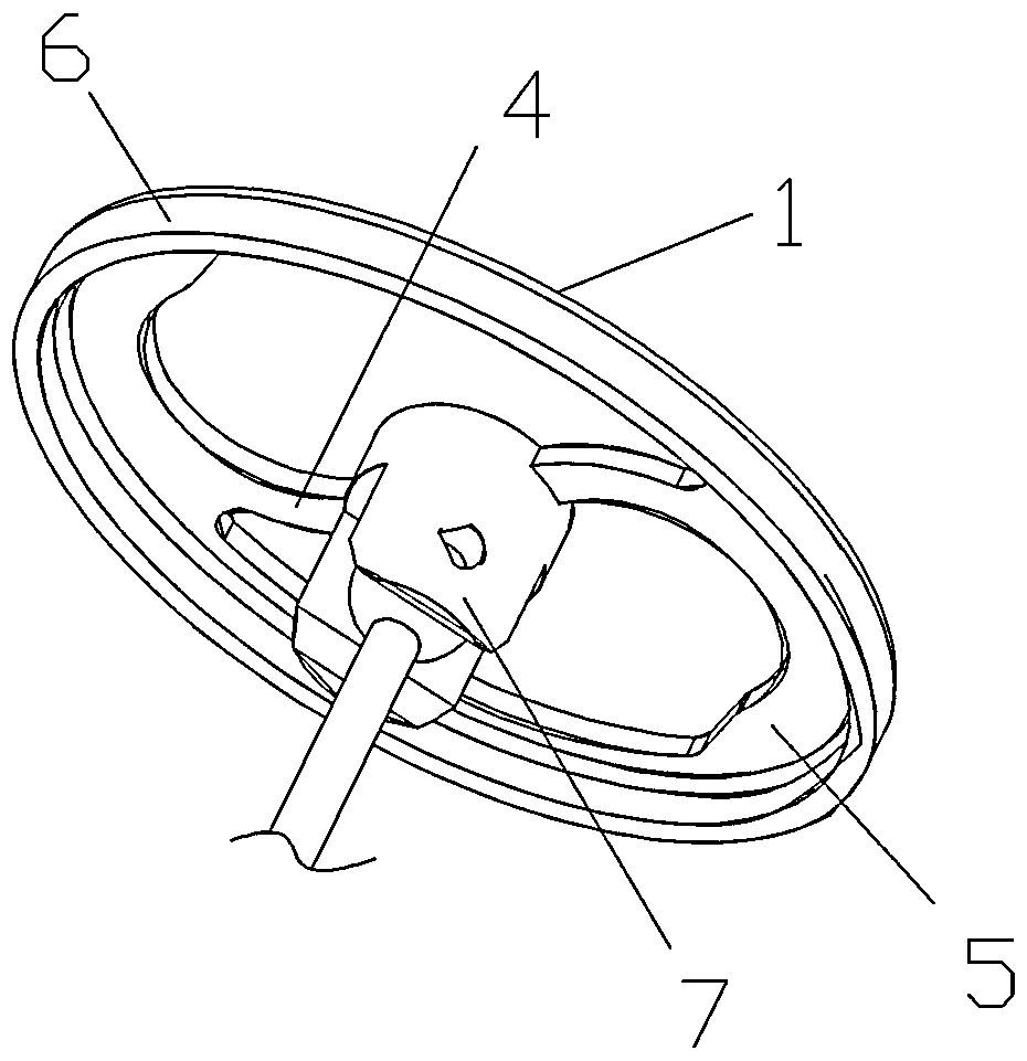 Auditory ossicle prosthesis capable of buffering pressure