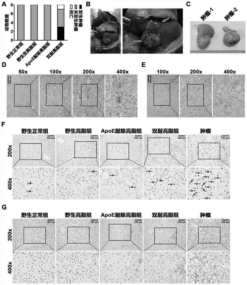 Construction method and application of non-alcoholic steatohepatitis mouse model based on PEDF/ApoE double-gene knockout