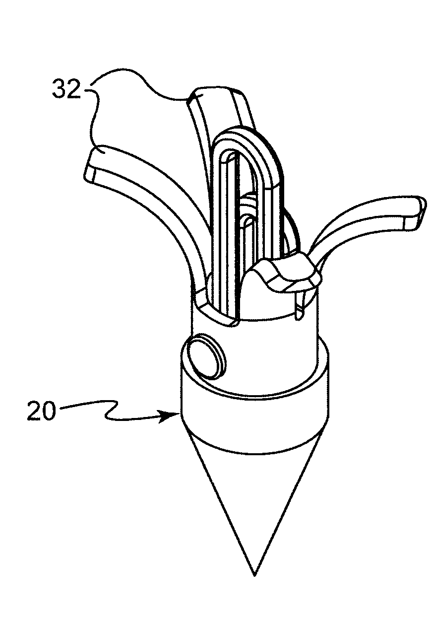 Bone anchor comprising a shape memory element and utilizing temperature transition to secure the bone anchor in bone