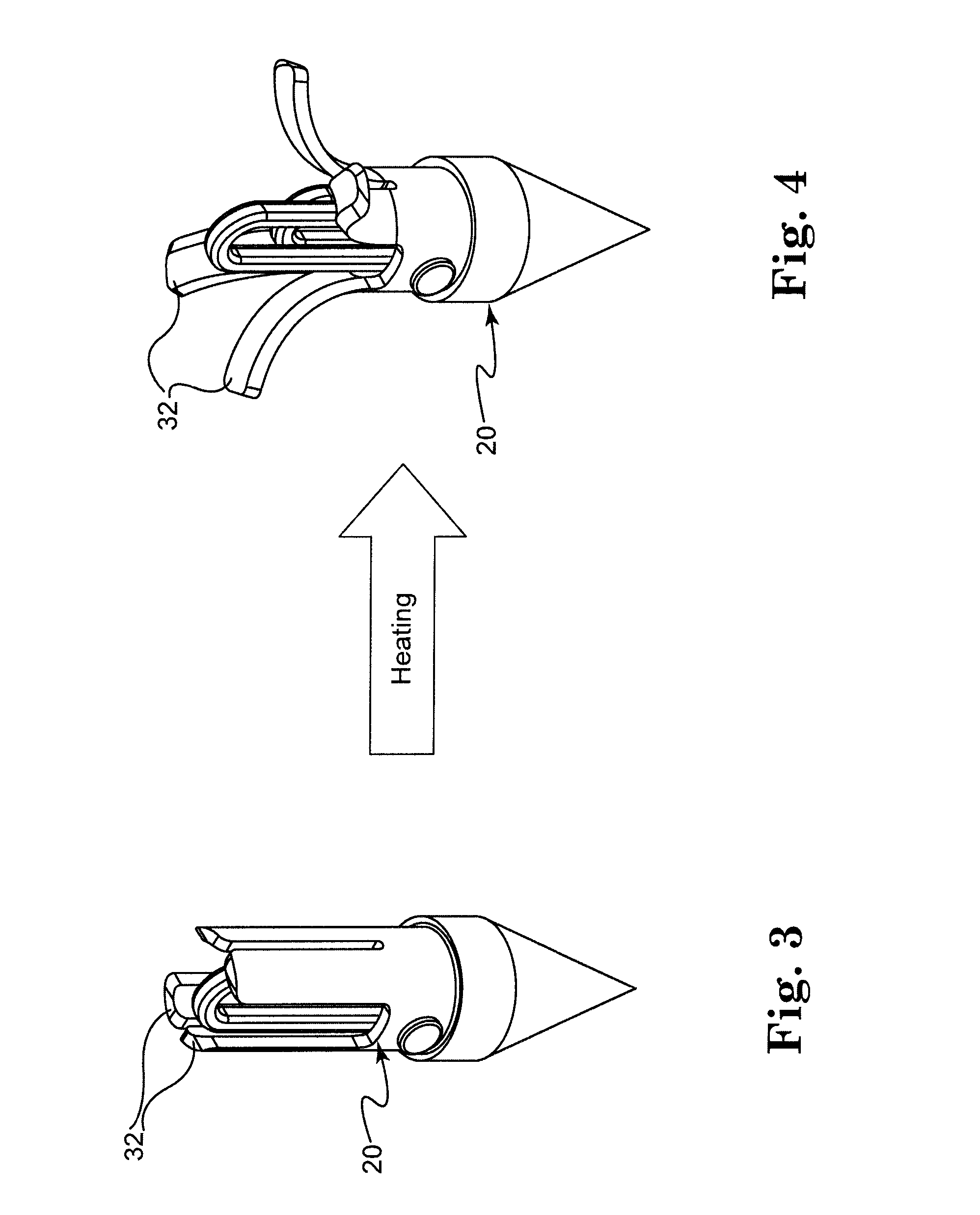 Bone anchor comprising a shape memory element and utilizing temperature transition to secure the bone anchor in bone