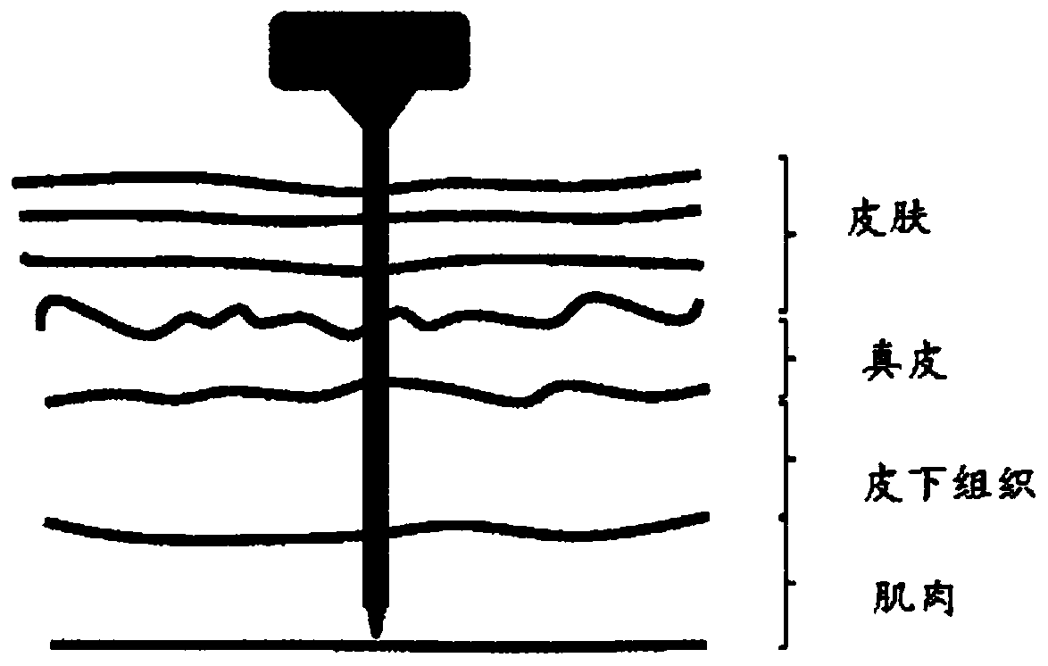 Needle for a syringe, syringe and corresponding control system