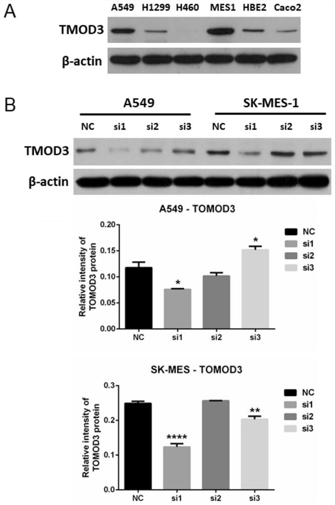 Application of TMOD3 and/or ADSL in non-small cell carcinoma