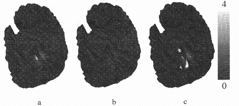 Related prediction model-based method for detecting structural deformation in magnetic resonance image