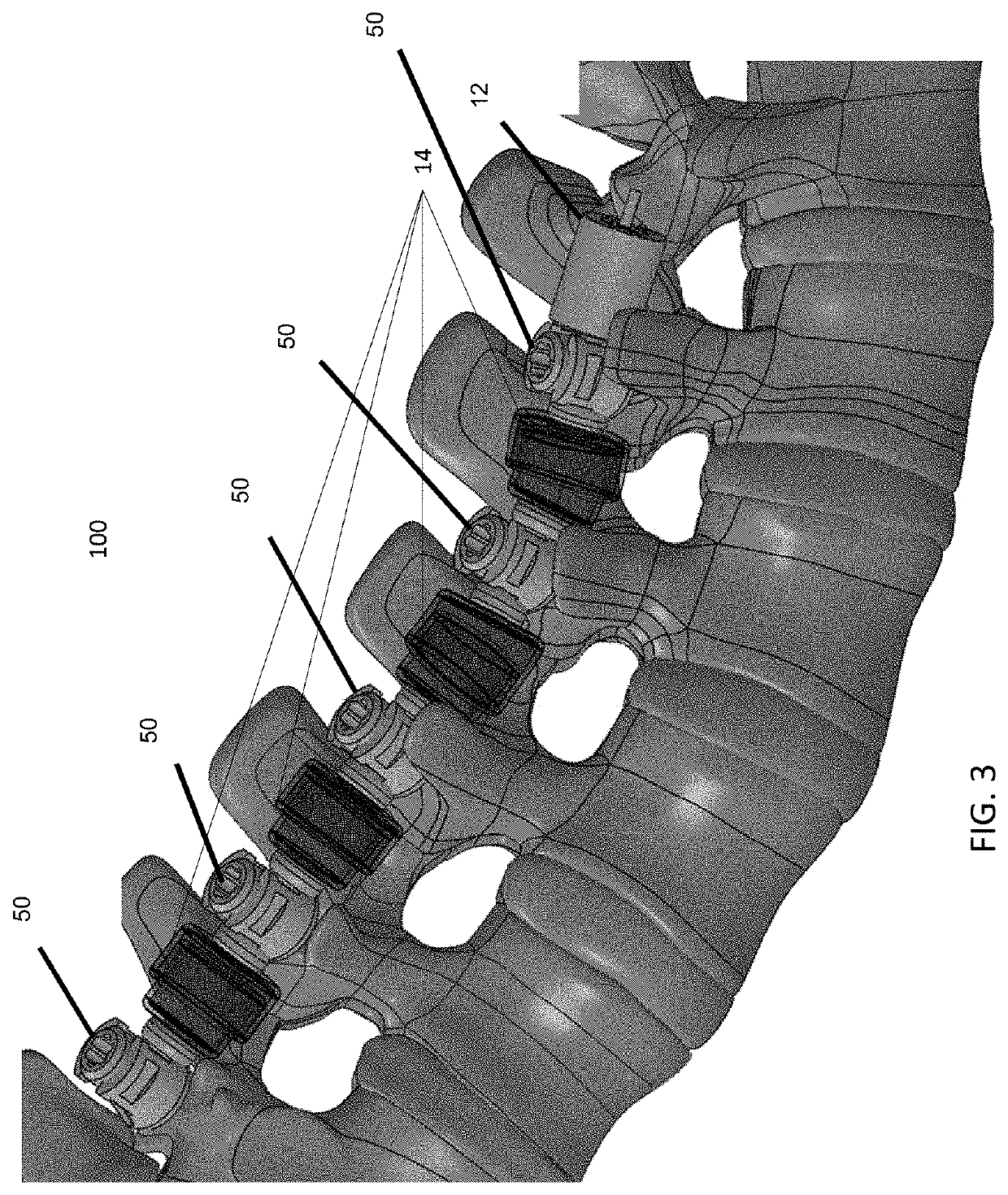 Spinal alignment system with thermally actuated component