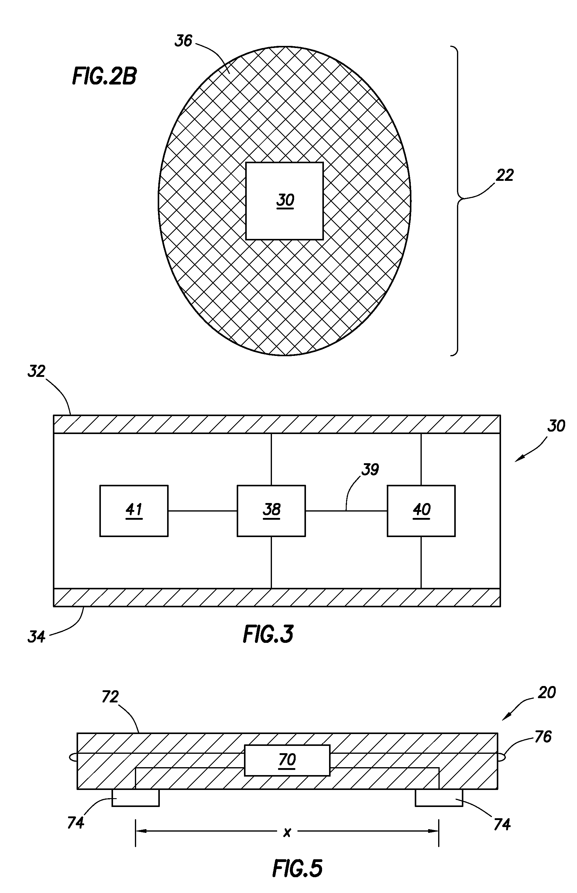 Evaluation of gastrointestinal function using portable electroviscerography systems and methods of using the same