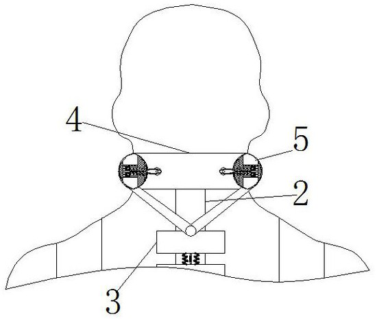 A device for extracting cerebrospinal fluid from patients with hematological tumors