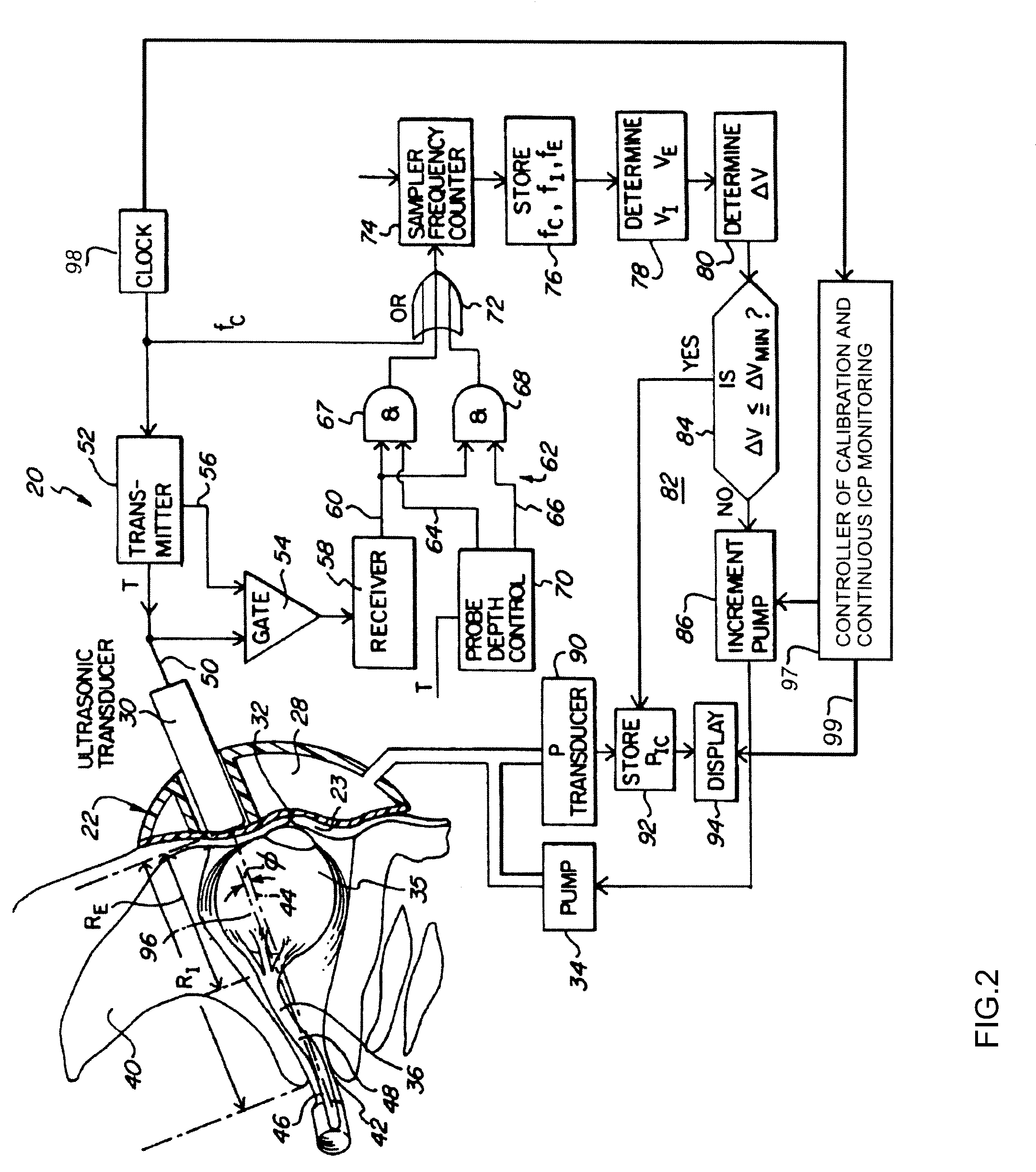 Method and Apparatus for Continuously Monitoring Intracranial Pressure
