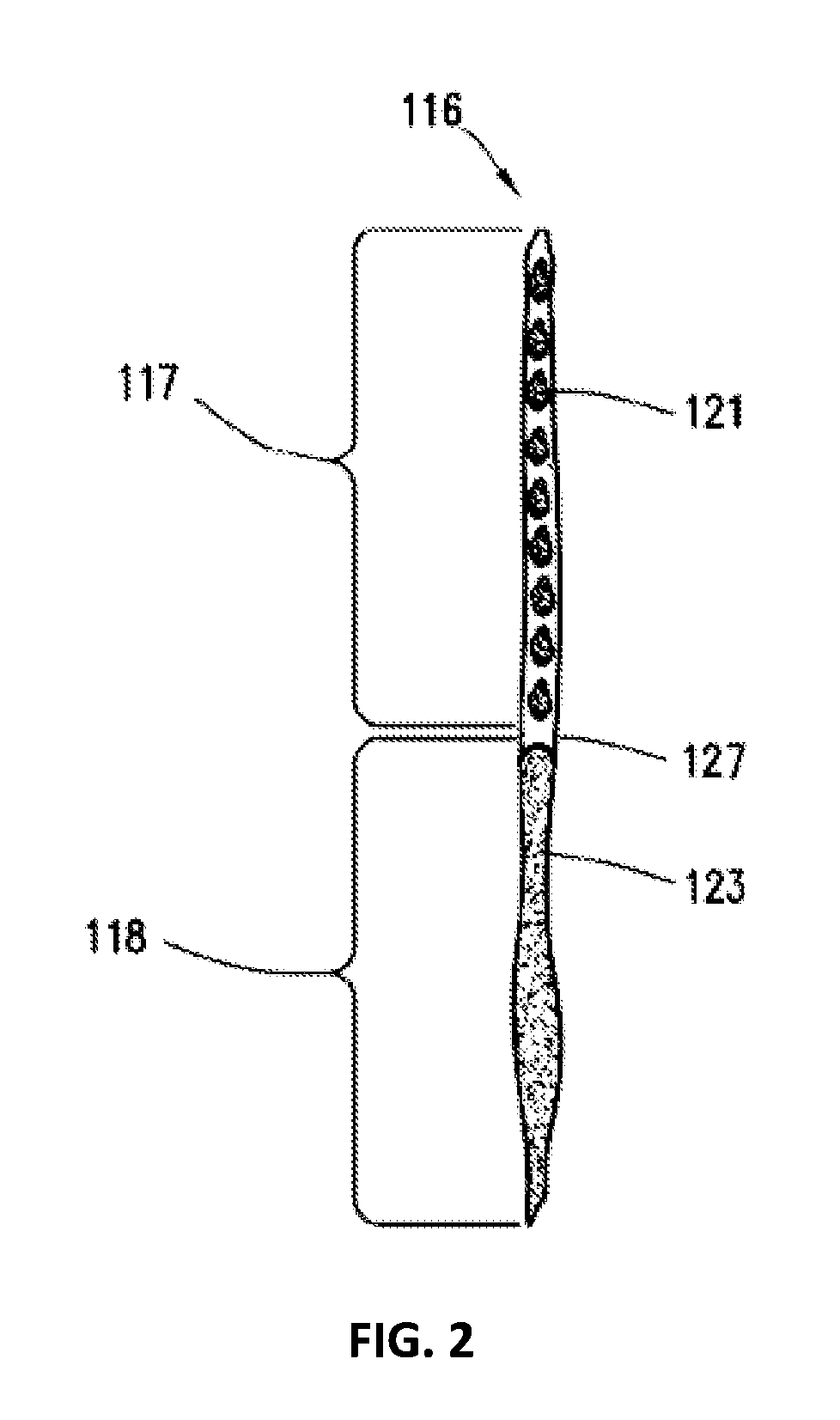 Forming conductive arch channels in subterranean formation fractures