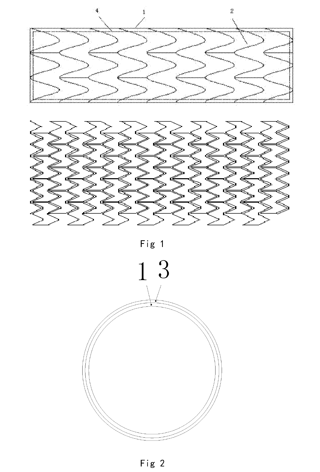 Balloon expandable, bioabsorbable, drug-coated sinus stent