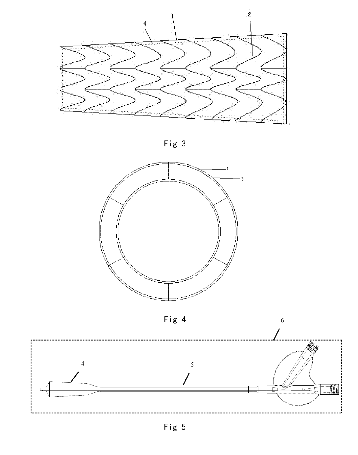 Balloon expandable, bioabsorbable, drug-coated sinus stent
