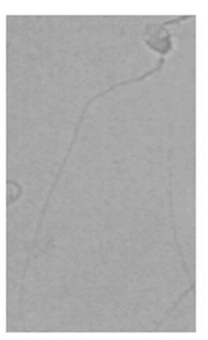 Method for simultaneously detecting completeness of sperm nucleus protein and membrane