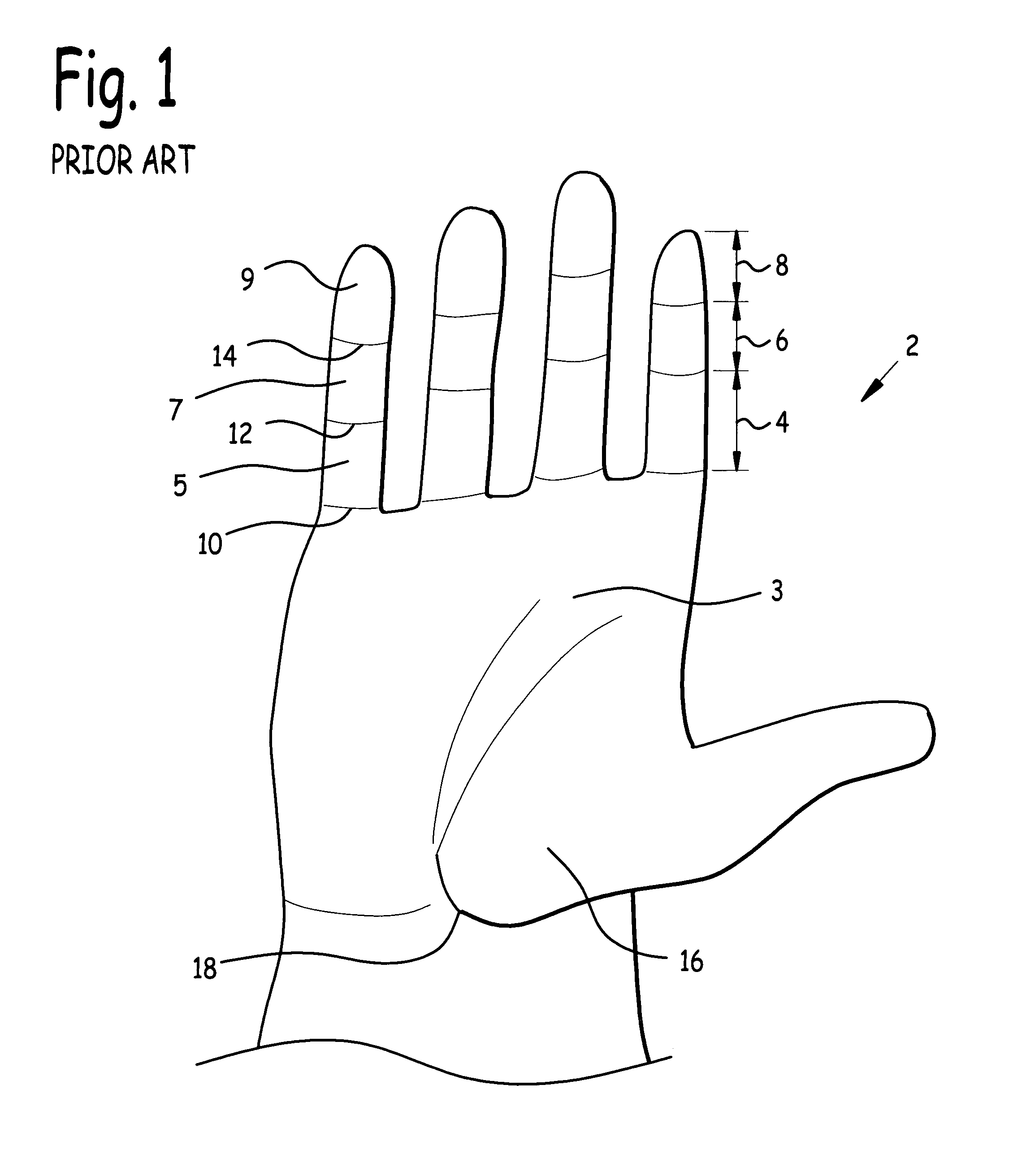 Exercise glove for intrinsic muscles and method of use