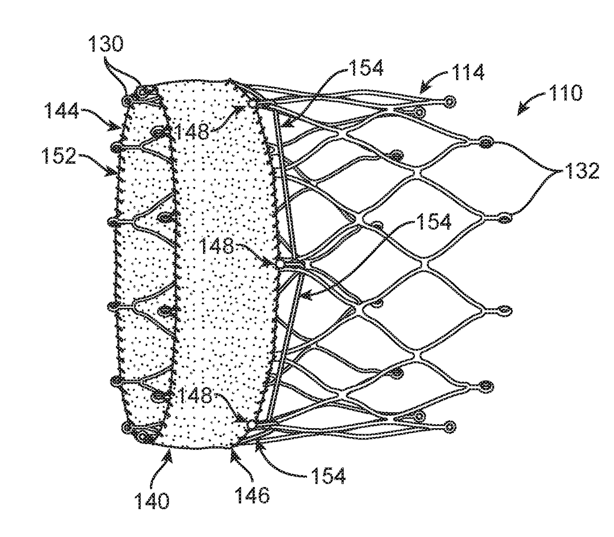 Stented prosthetic heart valve having wrap and methods of delivery and deployment