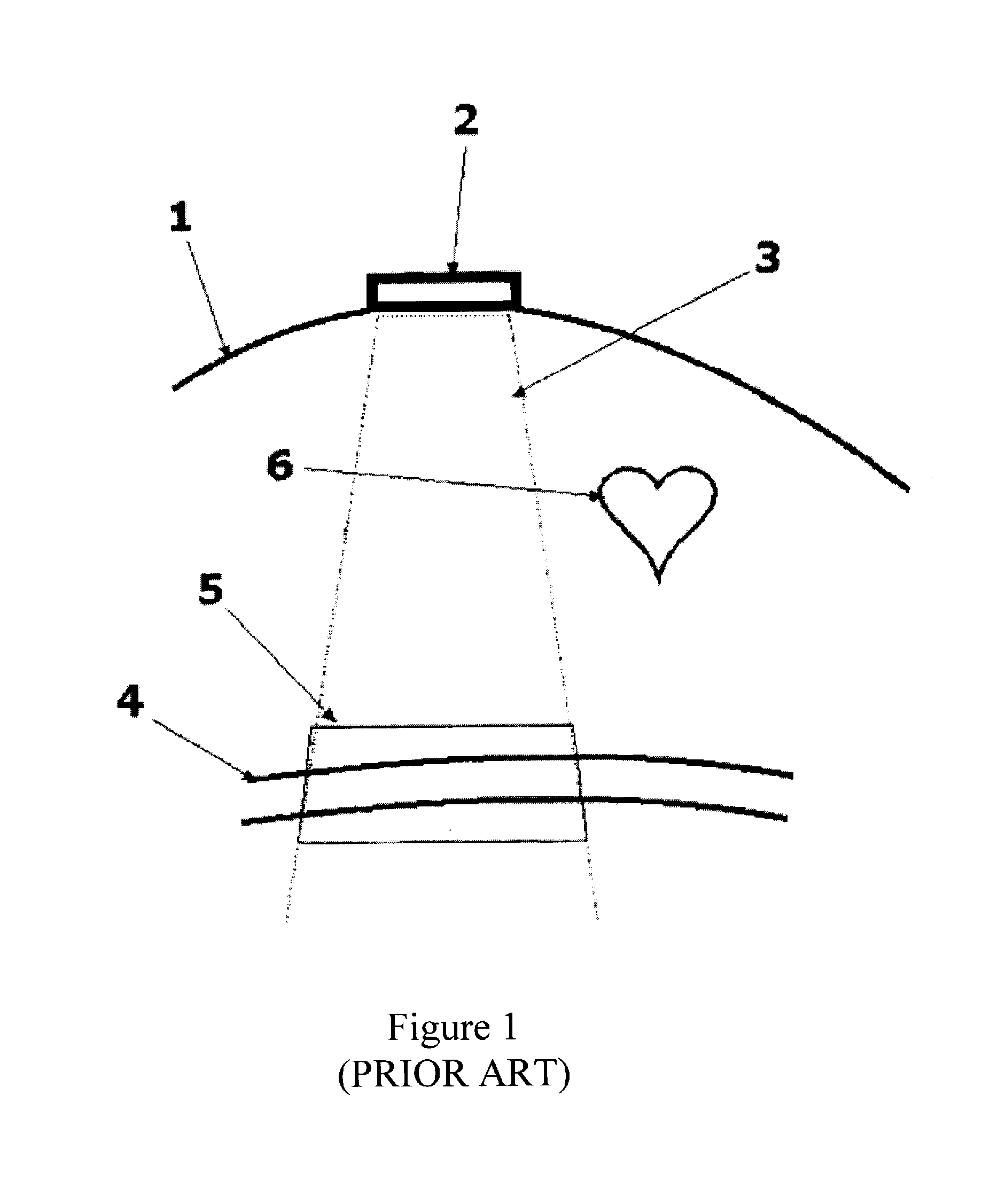 Fetal heart monitoring