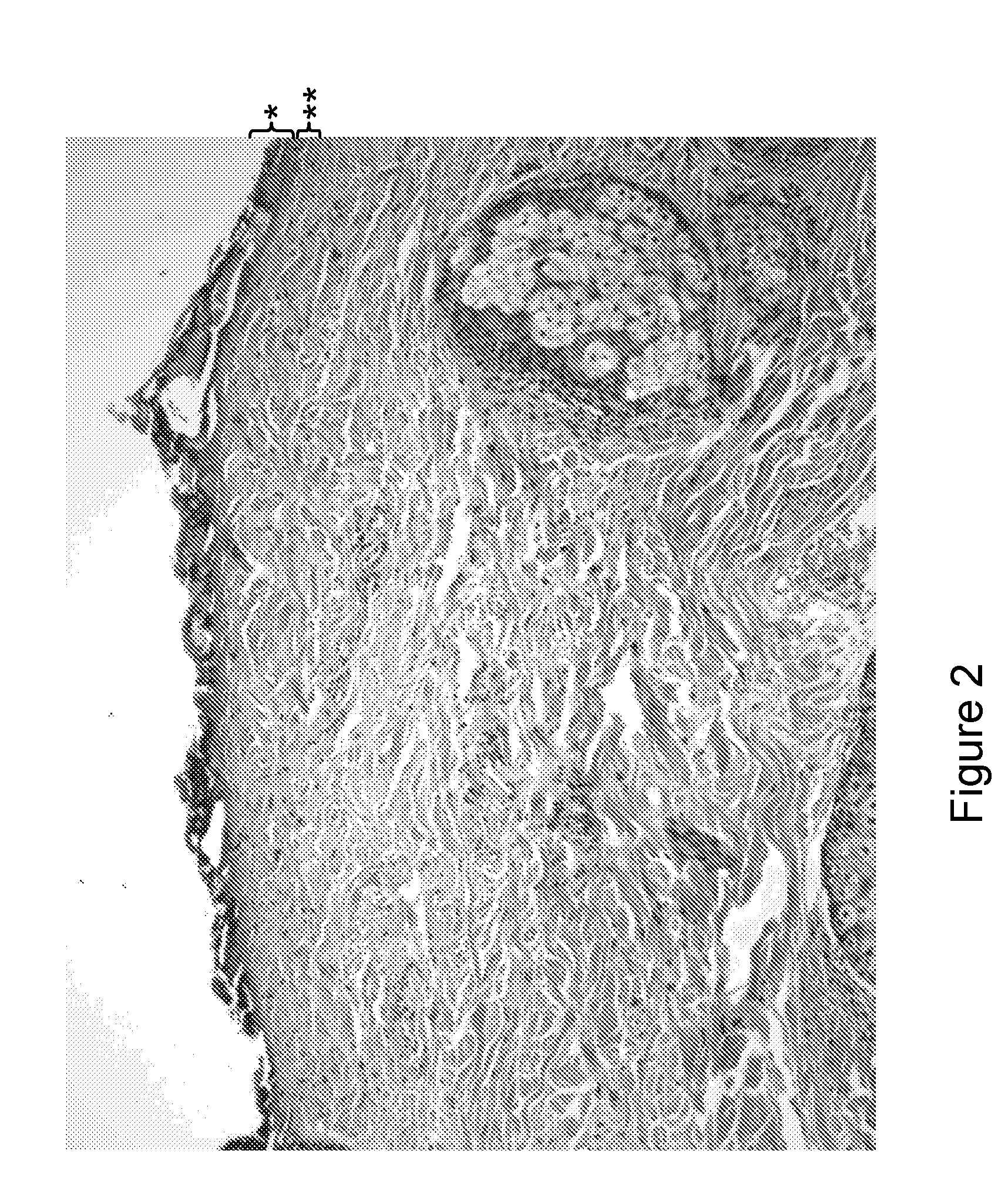 Method and device for treating skin by superficial coagulation