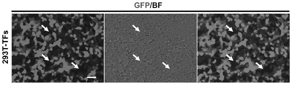 Method for preparing inhibitory interneurons capable of retaining age characteristics from non-nerve cell transformation